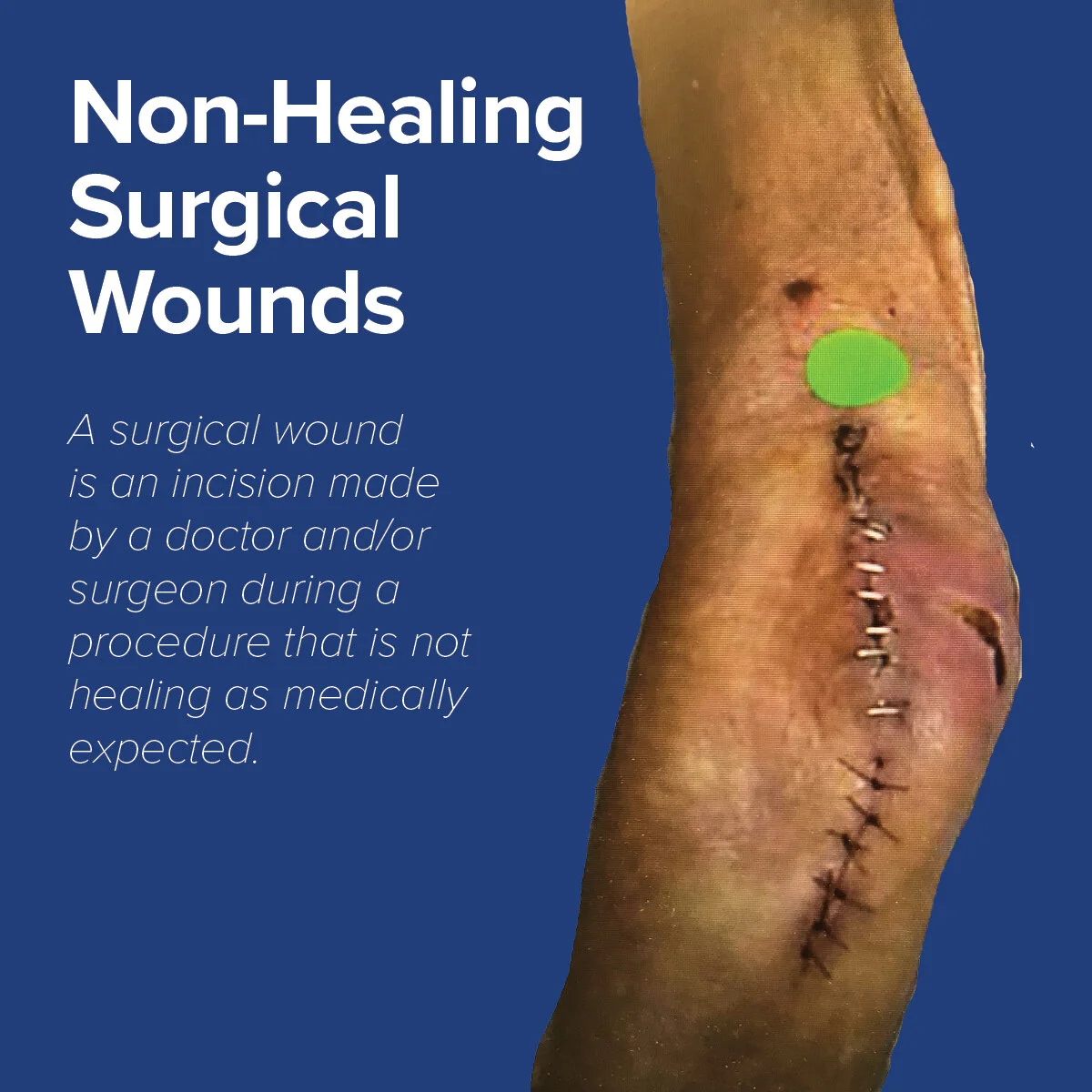 CHRISTUS Wound Care Medical Center San Antonio | WoundCentrics, LLC